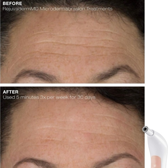 Trophy Skin RejuvadermMD - Picture 8 of 8